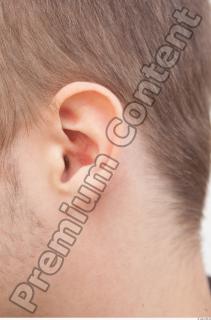 Ear texture of street references 418 0001